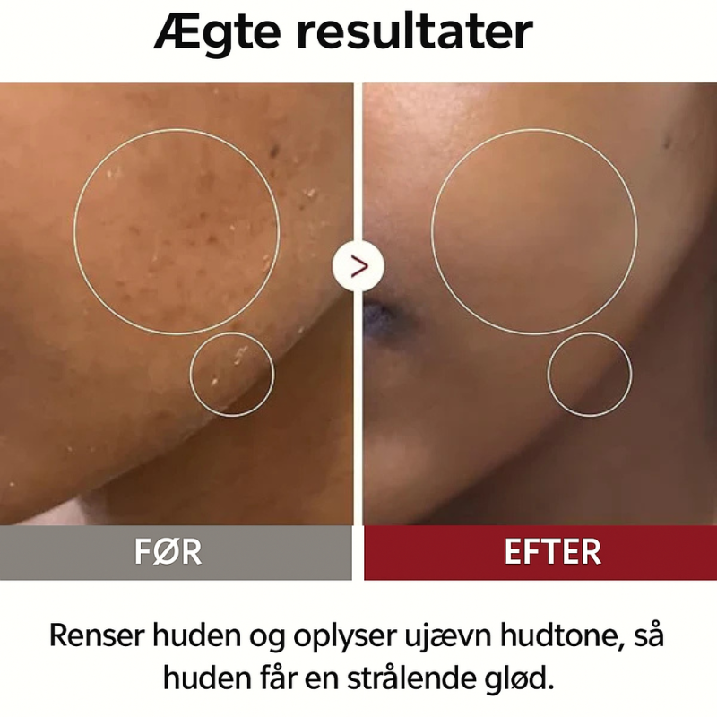 Dr. Melaxin - Rice Peel Shot Duo | Glød & Tekstur